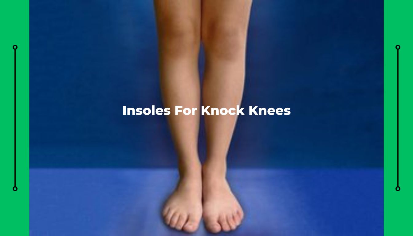 Shoe Inserts for Knock Knees